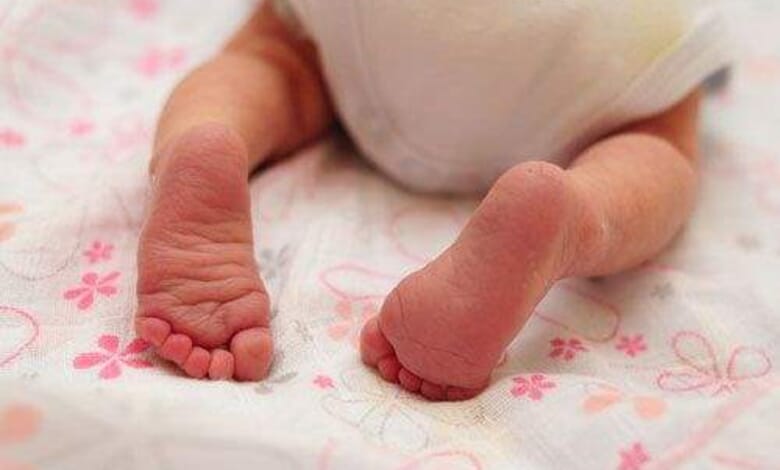 Bebeklerde Ayak Kızarıklıkları Sebepleri Nelerdir? 1 Bebeklerde Ayak Kızarıklıkları Sebepleri Nelerdir? 1